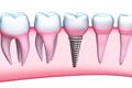 imagen 1 Clínica Dental Suárez Núñez